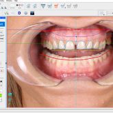 Digital Smile Design Screenshot Software