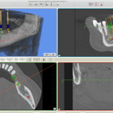 Zahnarzt Euskirchen Zahnimplantate Screenshot Software