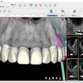 Digital Smile Design Screenshot Software